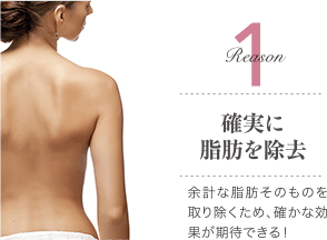 Reason 1 確かな痩身効果 / 余計な脂肪そのものを取り除くため、確かな効果が期待できる！