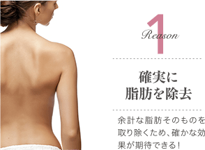 Reason 1 確かな痩身効果 / 余計な脂肪そのものを取り除くため、確かな効果が期待できる！