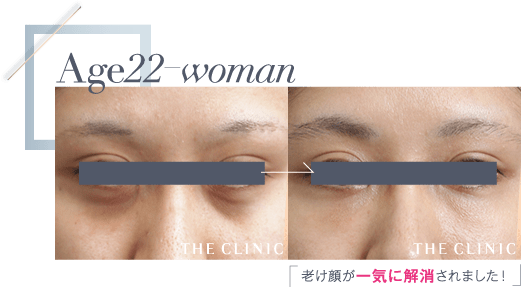 Age22 老け顔が一気に解消されました!