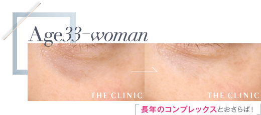 Age33 長年のコンプレックスとおさらば！