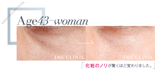 Age43 化粧のノリが驚くほど変わりました。