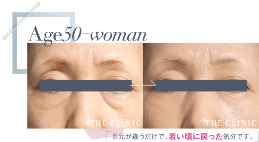 Age50 目元が違うだけで、若い頃に戻った気分です。