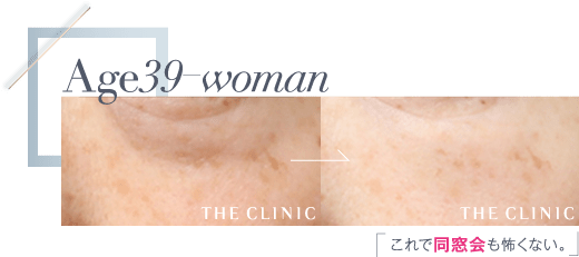 Age39 これで同窓会も怖くない。