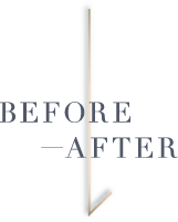 BEFORE-AFTER