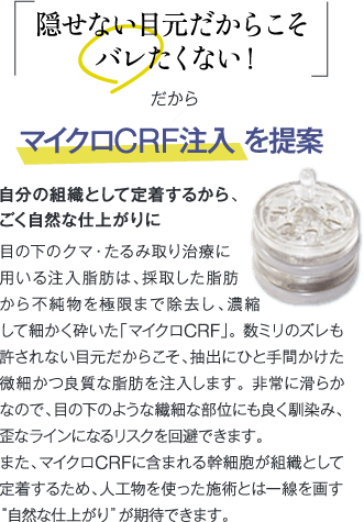 隠せない目元だからこそバレたくない! | だから マイクロCRF注入を提案 | 自分の組織として定着するから、ごく自然な仕上がりに | 目の下のクマ・たるみ取り治療に用いる注入脂肪は、採取した脂肪から不純物を極限まで除去し、濃縮して細かく砕いた「マイクロCRF」。数ミリのズレも許されない目元だからこそ、抽出にひと手間かけた微細かつ良質な脂肪を注入します。非常に滑らかなので、目の下のような繊細な部位にも良く馴染み、歪なラインになるリスクを回避できます。また、マイクロCRFに含まれる幹細胞が組織として定着するため、人工物を使った施術とは一線を画す“自然な仕上がり”が期待できます。