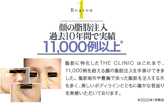 Reason 1 顔の脂肪注入過去10年間で実績11,000例以上 | 脂肪に特化したTHE CLINIC は、これまで11,000例を超える顔の脂肪注入を手掛けてきました。脂肪吸引や豊胸で余った脂肪を注入する方も多く、美しいボディラインとともに確かな若返りを実感いただいております。※2020年1月時点