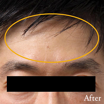 After