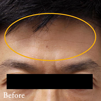 Before