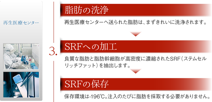 3,脂肪の洗浄→SRFへの加工→SRFの保存