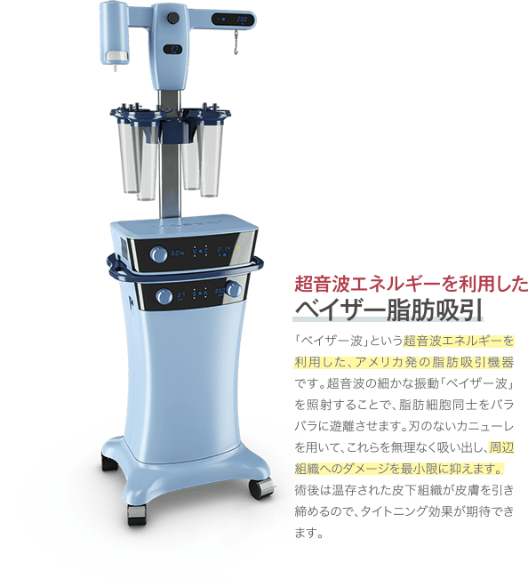 超音波エネルギーを利用したベイザー脂肪吸引｜「ベイザー波」という超音波エネルギーを利用した、アメリカ発の脂肪吸引機器です。超音波の細かな振動「ベイザー波」を照射することで、脂肪細胞同士をバラバラに遊離させます。刃のないカニューレを用いて、これらを無理なく吸い出し、周辺組織へのダメージを最小限に抑えます。術後は温存された皮下組織が皮膚を引き締めるので、タイトニング効果が期待できます。