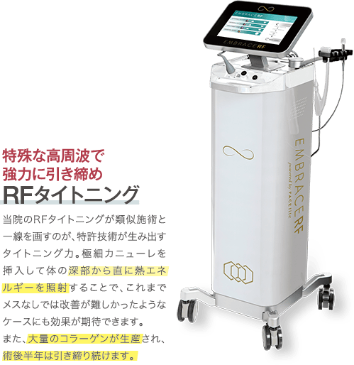 特殊な高周波で強力に引き締め RFタイトニング｜当院のRFタイトニングが類似施術と一線を画すのが、特許技術が生み出すタイトニング力。極細カニューレを挿入して体の深部から直に熱エネルギーを照射することで、これまでメスなしでは改善が難しかったようなケースにも効果が期待できます。 また、大量のコラーゲンが生産され、術後半年は引き締り続けます。