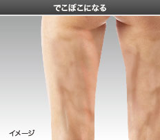 でこぼこになる