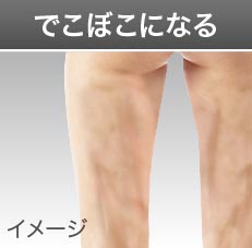 でこぼこになる