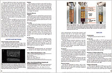 米国形成外科雑誌2016年4月号に掲載された論文(抜粋)