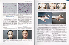 米国形成外科雑誌2018年7月号に掲載された論文(抜粋)