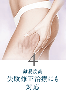 4. 難易度高失敗修正治療にも対応