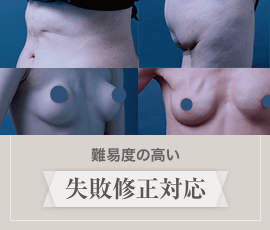 難易度の高い失敗修正対応