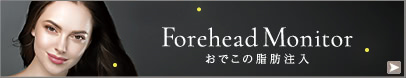 おでこを丸くする脂肪注入モニター募集
