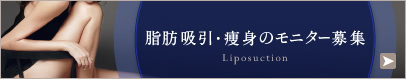 脂肪吸引のモニター募集