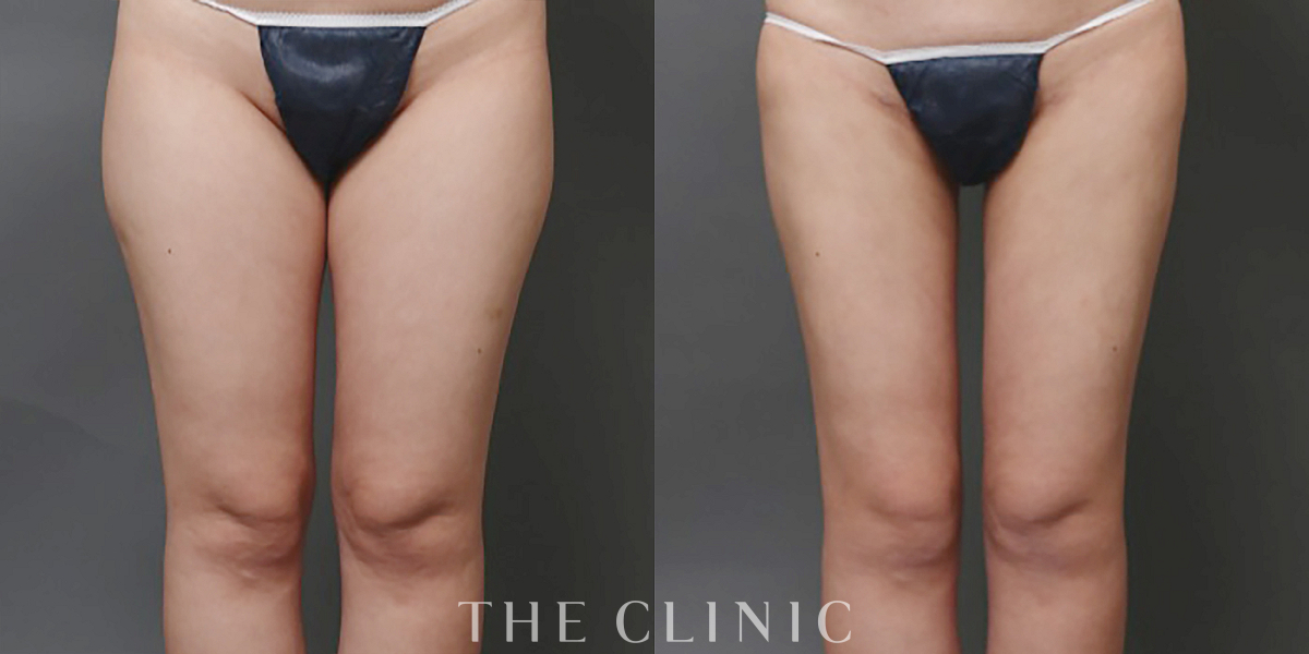 THECLINIC症例写真