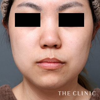 【THE CLINIC 症例画像】No.1065_1