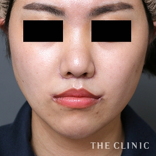 【THE CLINIC 症例画像】No.1065_2