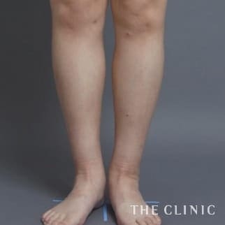 【THE CLINIC 症例画像】No.112_1