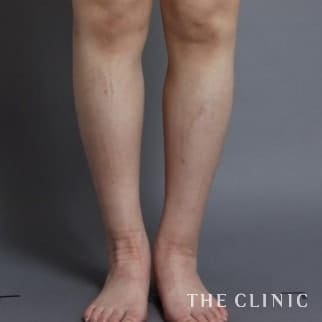 【THE CLINIC 症例画像】No.112_2