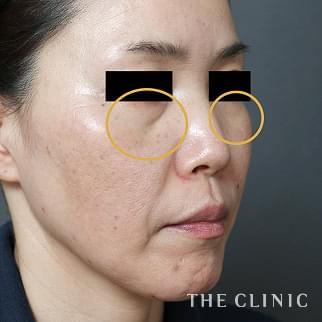 【THE CLINIC 症例画像】No.1205_1