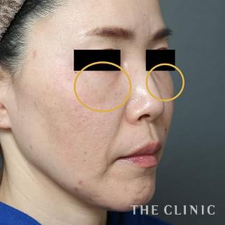 【THE CLINIC 症例画像】No.1205_2