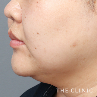 【THE CLINIC 症例画像】No.1286_1