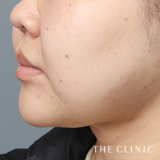 【THE CLINIC 症例画像】No.1286_2