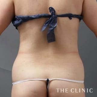 【THE CLINIC 症例画像】No.12_1