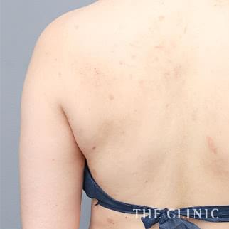 【THE CLINIC 症例画像】No.1307_1