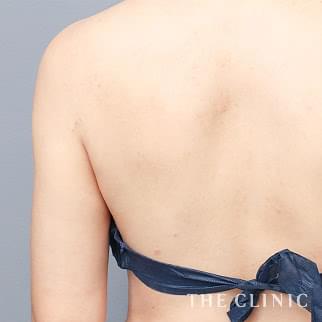 【THE CLINIC 症例画像】No.1307_2