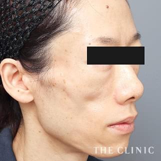 【THE CLINIC 症例画像】No.1332_1