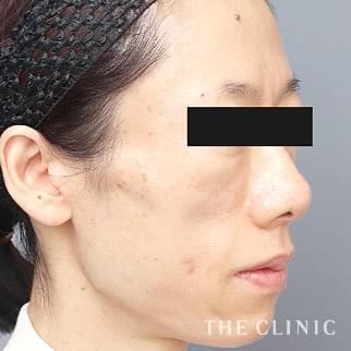 【THE CLINIC 症例画像】No.1332_2