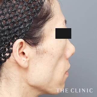 【THE CLINIC 症例画像】No.1333_1