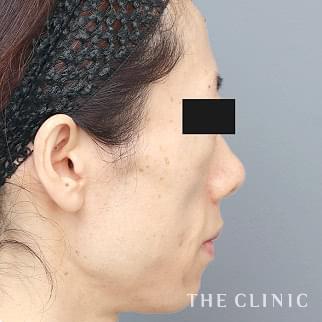 【THE CLINIC 症例画像】No.1333_2