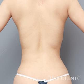 【THE CLINIC 症例画像】No.1352_2