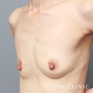 【THE CLINIC 症例画像】No.1365_1