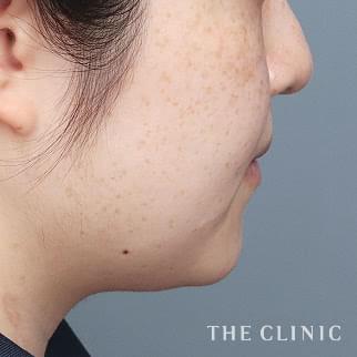 【THE CLINIC 症例画像】No.1368_1