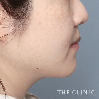 【THE CLINIC 症例画像】No.1368_2