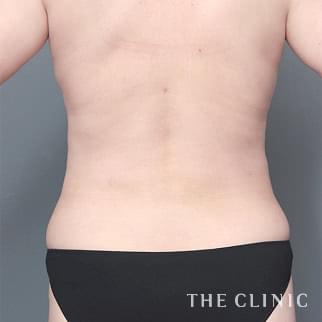 【THE CLINIC 症例画像】No.1369_2