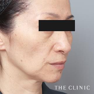 【THE CLINIC 症例画像】No.1377_1