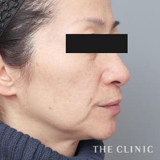 【THE CLINIC 症例画像】No.1377_2