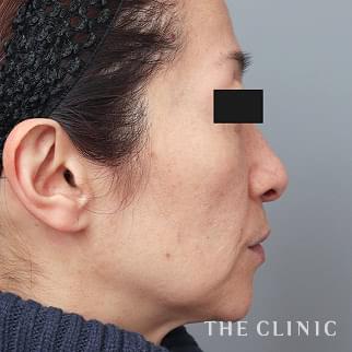 【THE CLINIC 症例画像】No.1378_2