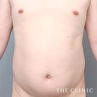 【THE CLINIC 症例画像】No.1404_1