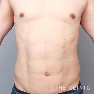 【THE CLINIC 症例画像】No.1404_2