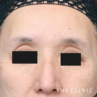 【THE CLINIC 症例画像】No.1420_1